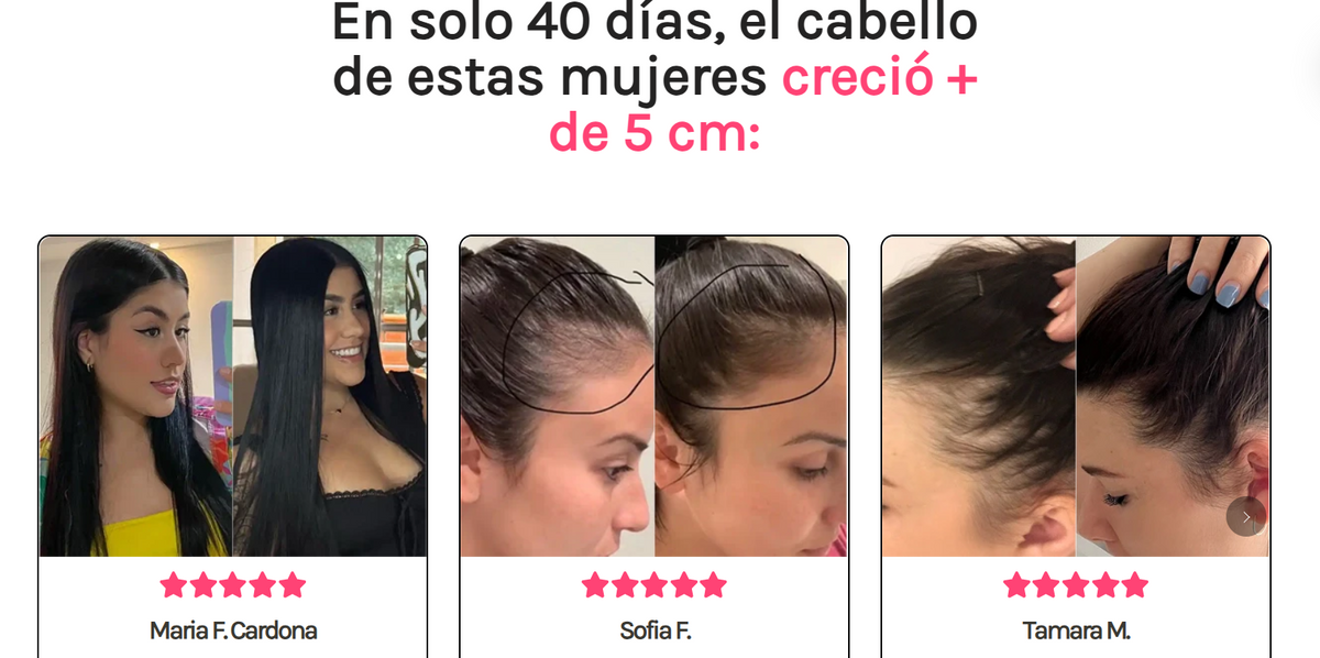 Rosa Hair | Biotina + Vitaminas para Cabello, Piel y Uñas